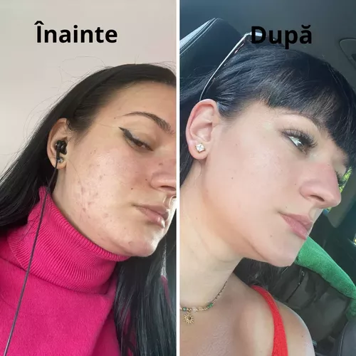 Pachet DETOXIFIANT - In Green, mix verde antibalonare + CADOU Flacon Spirulină 120 tablete ecologice | Rawboost